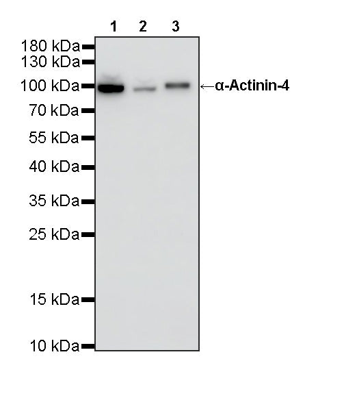 α-Actinin-4 Recombinant Rabbit mAb