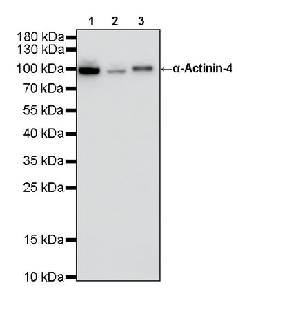 α-Actinin-4 Recombinant Rabbit mAb