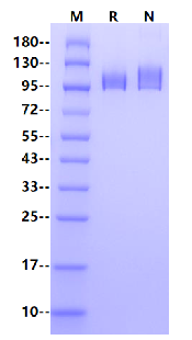 Envelope Glycoprotein B(gB) His Tag Protein, Epstein-Barr virus