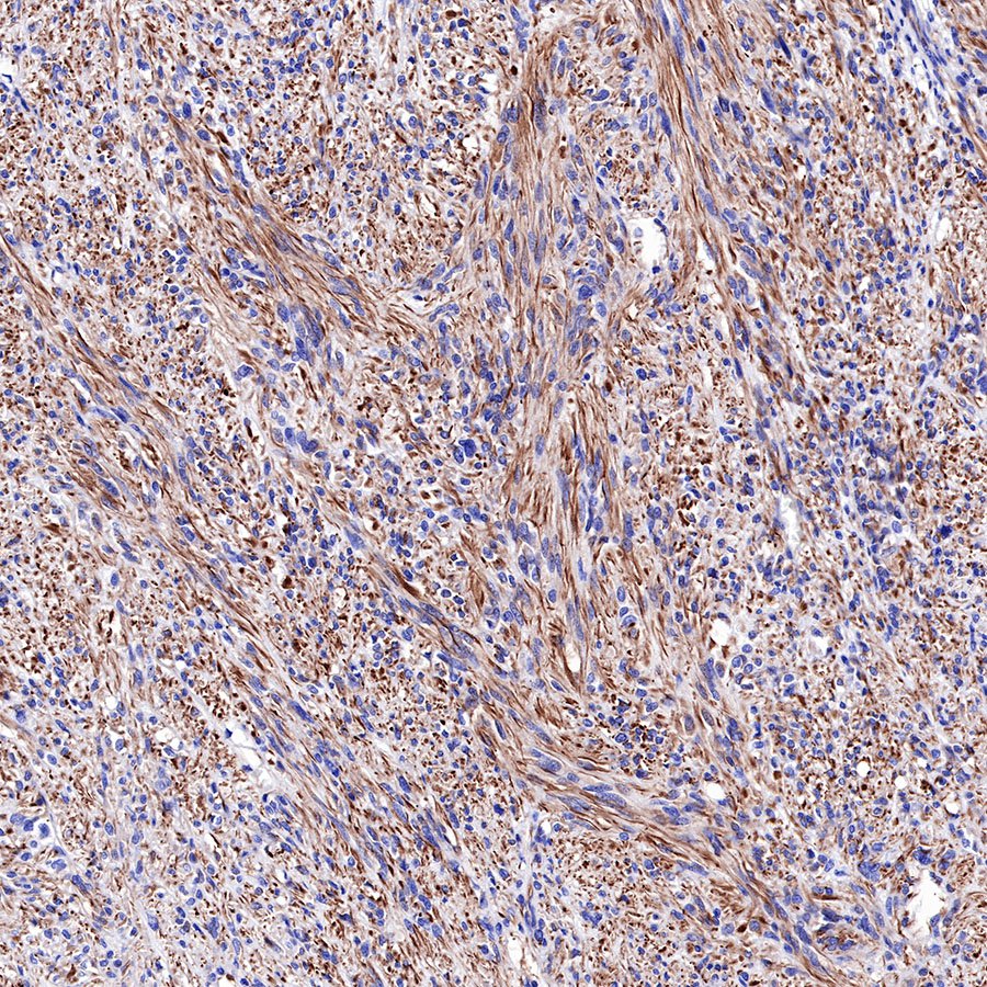Nestin Recombinant Rabbit mAb,PBS Only (SDT-R112)
