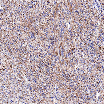 Nestin Recombinant Rabbit mAb,PBS Only (SDT-R112)