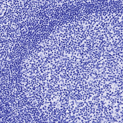 MUC2 Recombinant Rabbit mAb (SDT-345-9)