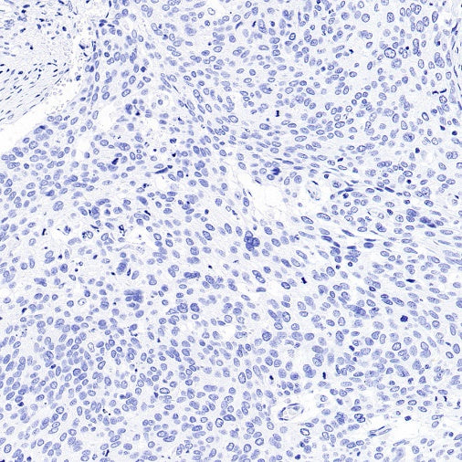 MDR3 Recombinant Rabbit mAb (SDT-1949-60)