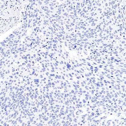 MDR3 Recombinant Rabbit mAb (SDT-1949-60)