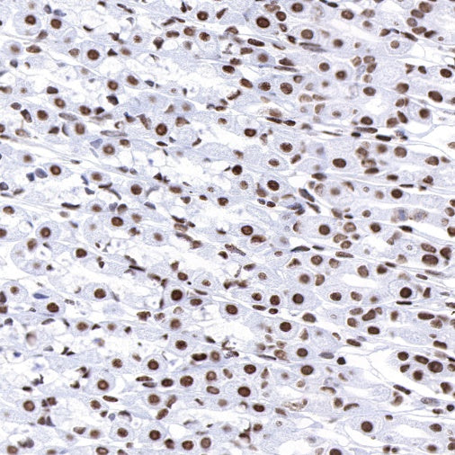 FUBP1 Recombinant Rabbit mAb (S-739-21)