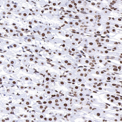 FUBP1 Recombinant Rabbit mAb (S-739-21)