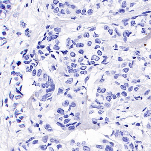SALL4 Recombinant Rabbit mAb (SDT-1484-1)