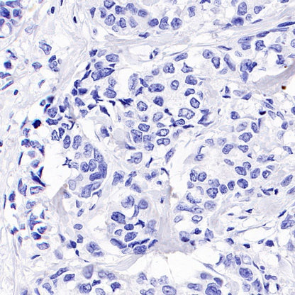 SALL4 Recombinant Rabbit mAb (SDT-1484-1)