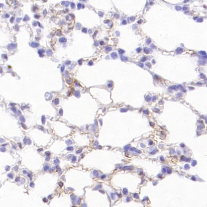 CD105 Recombinant Rabbit mAb (S-3764-11)