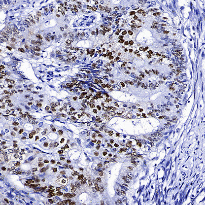 Cyclin E1 Recombinant Rabbit mAb (SDT-4375-44)