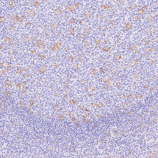 LILRB4 Recombinant Rabbit mAb (S-2504-22)