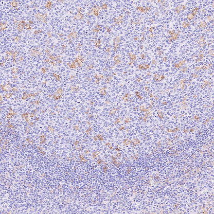 LILRB4 Recombinant Rabbit mAb (S-2504-22)