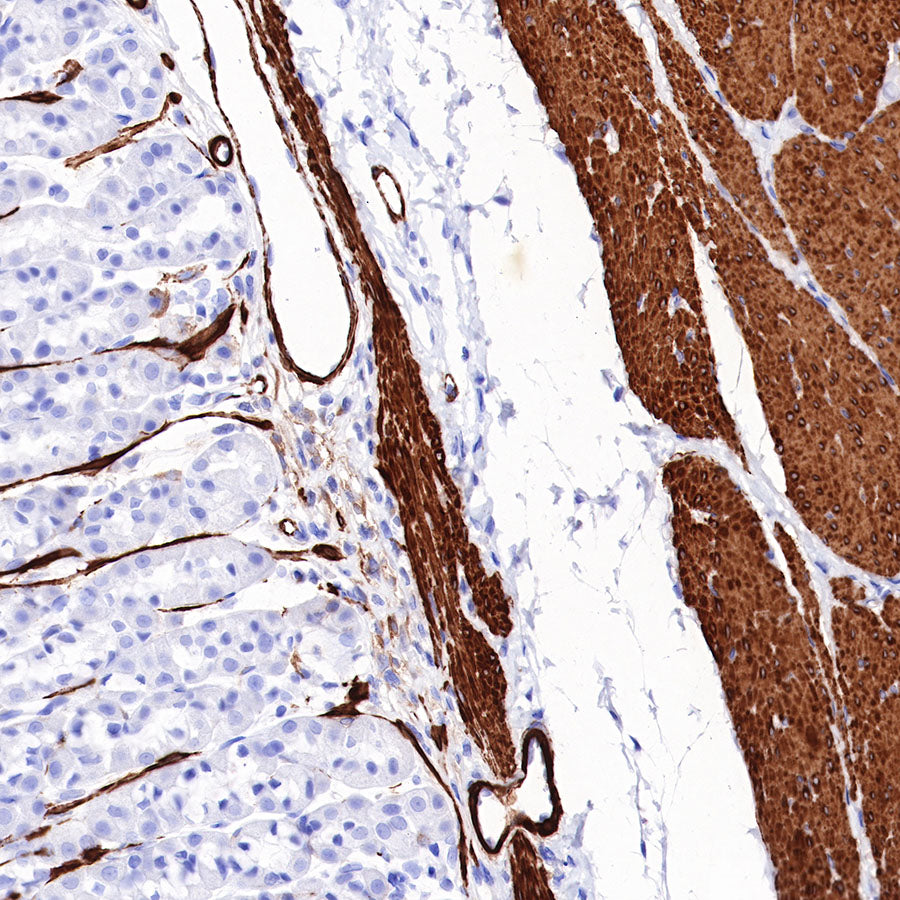 Myosin-11/SMMHC Recombinant Rabbit mAb,PBS Only (SDT-188-112)