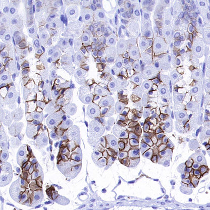ALCAM Recombinant Rabbit mAb (S-4080-40)
