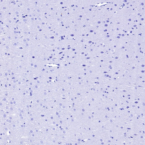 Myelin protein zero Recombinant Rabbit mAb (SDT-1225-8)