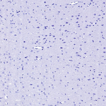 Myelin protein zero Recombinant Rabbit mAb (SDT-1225-8)
