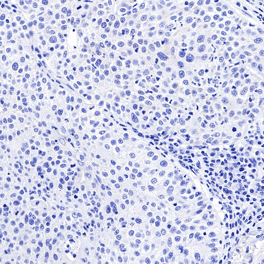 Keratin 18 Recombinant Rabbit mAb (SDT-R081)