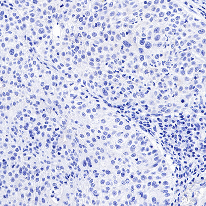Keratin 18 Recombinant Rabbit mAb (SDT-R081)