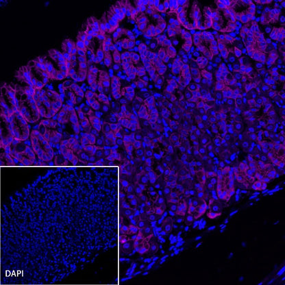 E-Cadherin Recombinant Rabbit mAb (Alexa Fluor® 647 Conjugate) (S-438-5)