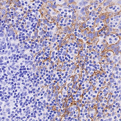 Claudin 3+Claudin 9 Recombinant Rabbit mAb (SDT-1452-69)