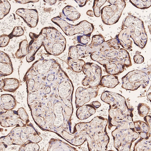 ERAP1 Recombinant Rabbit mAb (S-2509-38)