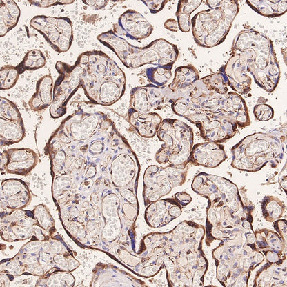 ERAP1 Recombinant Rabbit mAb (S-2509-38)