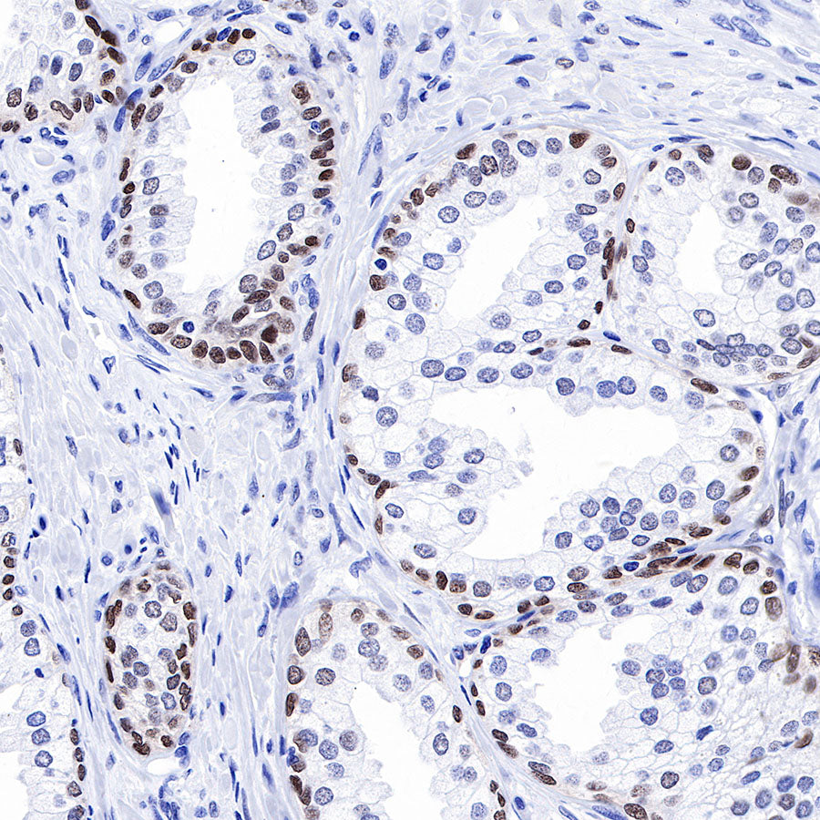SOX9 Recombinant Rabbit mAb (SDT-019-29)