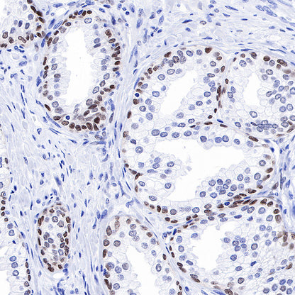SOX9 Recombinant Rabbit mAb (SDT-019-29)