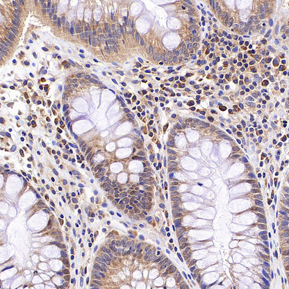 RPLP0 Rabbit Polyclonal Antibody