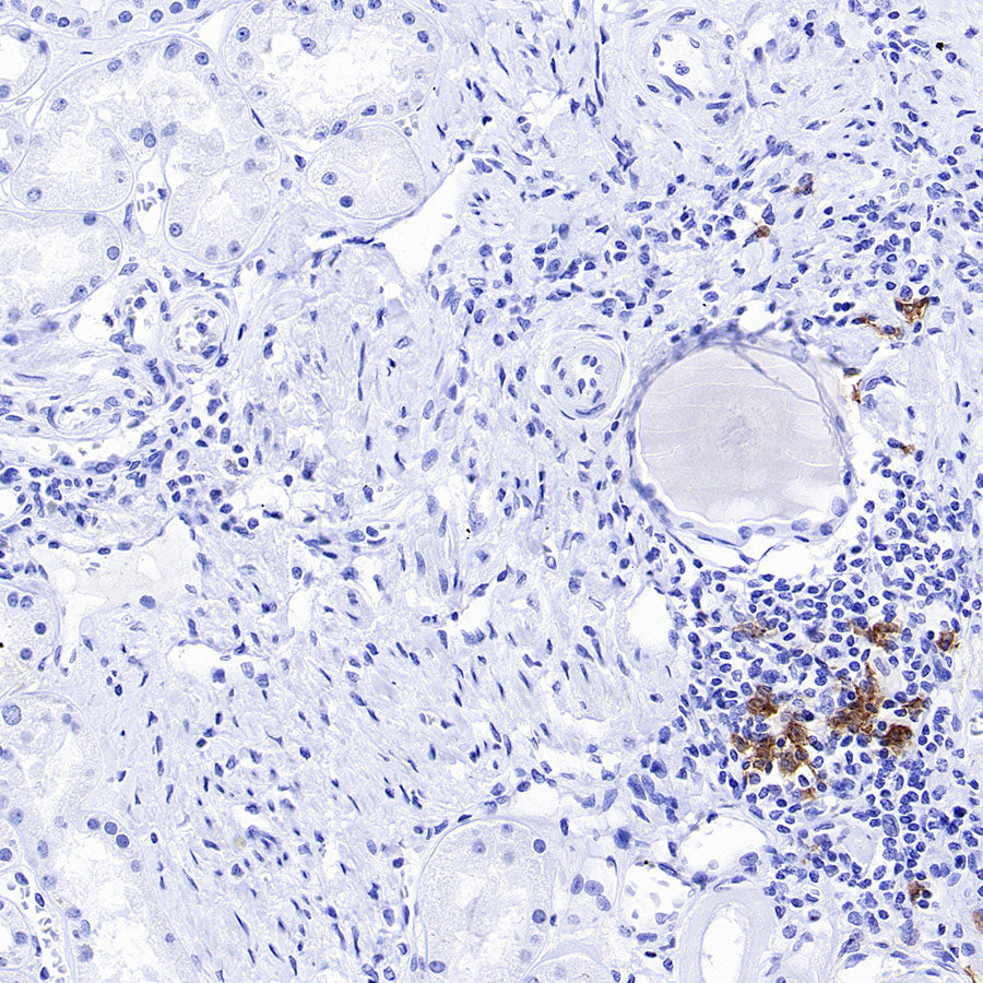 CLEC9A Recombinant Rabbit mAb (S-1904-154)