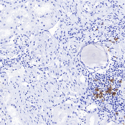 CLEC9A Recombinant Rabbit mAb (S-1904-154)