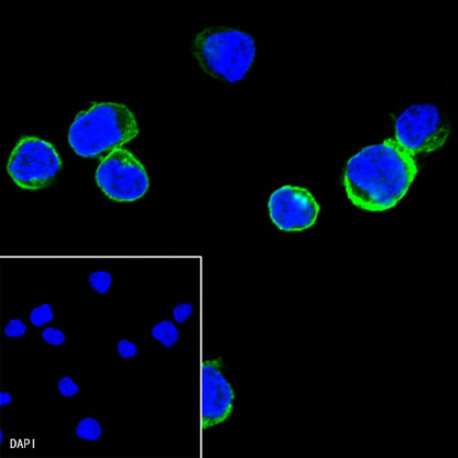Lck Recombinant Rabbit mAb (SDT-316-15)