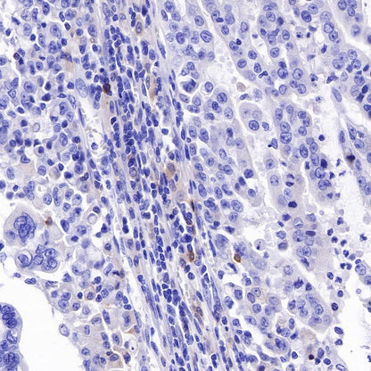 CD25/IL-2Rα Recombinant Rabbit mAb (S-R223)