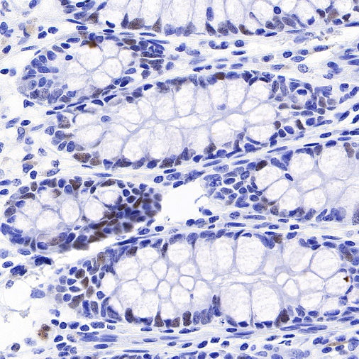 CHAF1b Recombinant Rabbit mAb (S-R316)