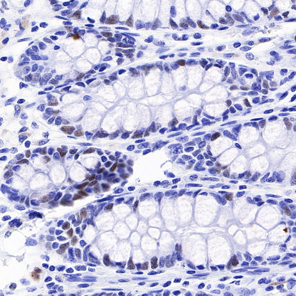 CHAF1b Recombinant Rabbit mAb (S-R316)