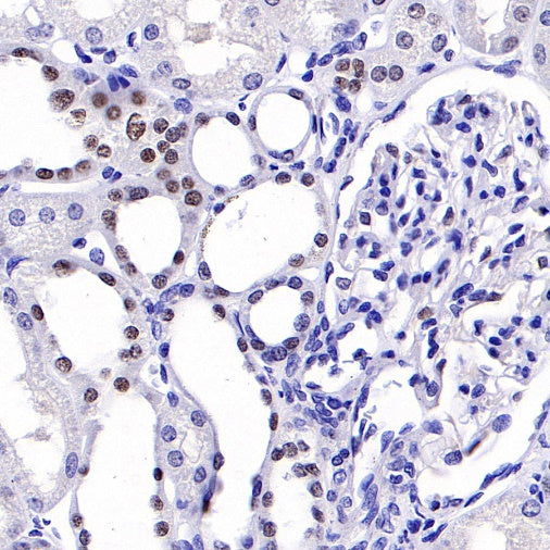 O-Linked N-Acetylglucosamine Rabbit mAb (S-R256)