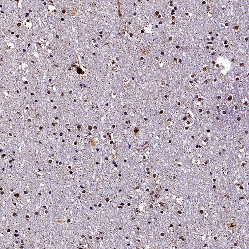 DNA Ligase IV/LIG4 Recombinant Rabbit mAb (S-2237-118)