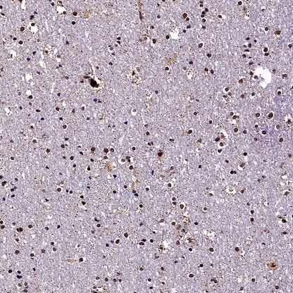 DNA Ligase IV/LIG4 Recombinant Rabbit mAb (S-2237-118)