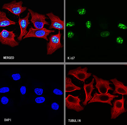 Ki67 Recombinant Mouse mAb (SDT-606-7)