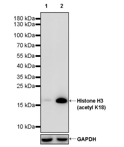 Histone H3 (acetyl K18) Recombinant Rabbit mAb (S-1688-90)