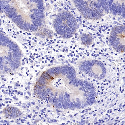 Phospho-IKKα/β (Ser176/180) Recombinant Rabbit mAb (S-4059)