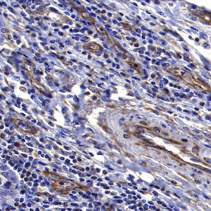 sFlt-1/VEGF Receptor 1 Recombinant Rabbit mAb (SDT-233-29)