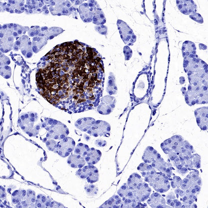 Somatostatin Receptor 2 Recombinant Rabbit mAb (SDT-2507-1)