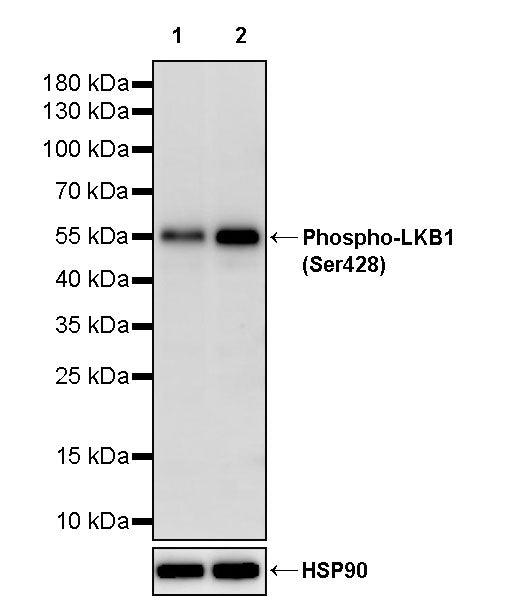 Phospho-LKB1 (Ser428) Recombinant Rabbit mAb (S-3489)