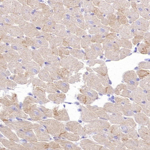 SLC8A1 Recombinant Rabbit mAb (S-3100-17)