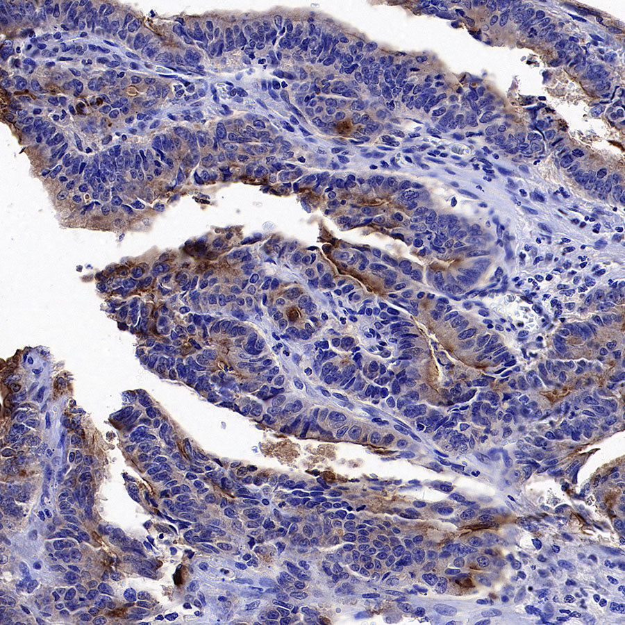 GPRC5A Recombinant Rabbit mAb (S-4383-15)