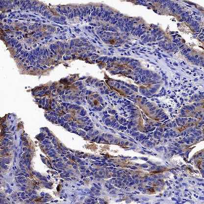 GPRC5A Recombinant Rabbit mAb (S-4383-15)