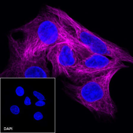 β-tubulin Recombinant Rabbit mAb (Cy5 Conjugate) (S-312-113)