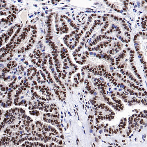 FUS Recombinant Rabbit mAb (S-1015-21)