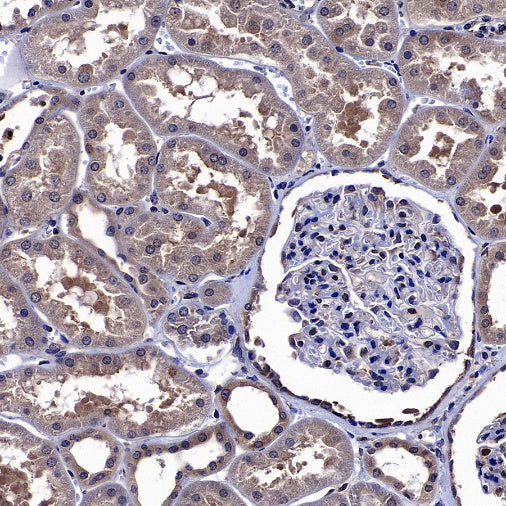 TRIM25 Recombinant Rabbit mAb (S-4069-59)